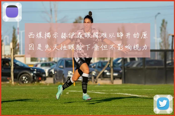 西媒揭示赫伊森眼睛难以睁开的原因是先天性眼睑下垂但不影响视力